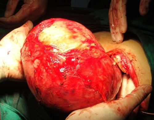 肿瘤照片,揭示癌症的视觉秘密